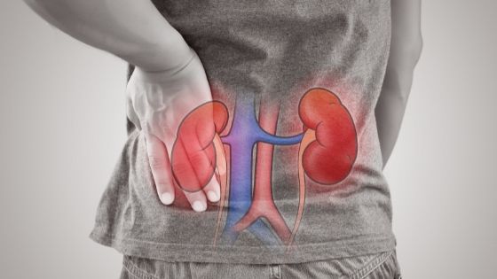 What is the Final Stage of Kidney Failure